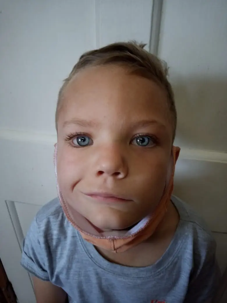 artificialeyecentre capetown